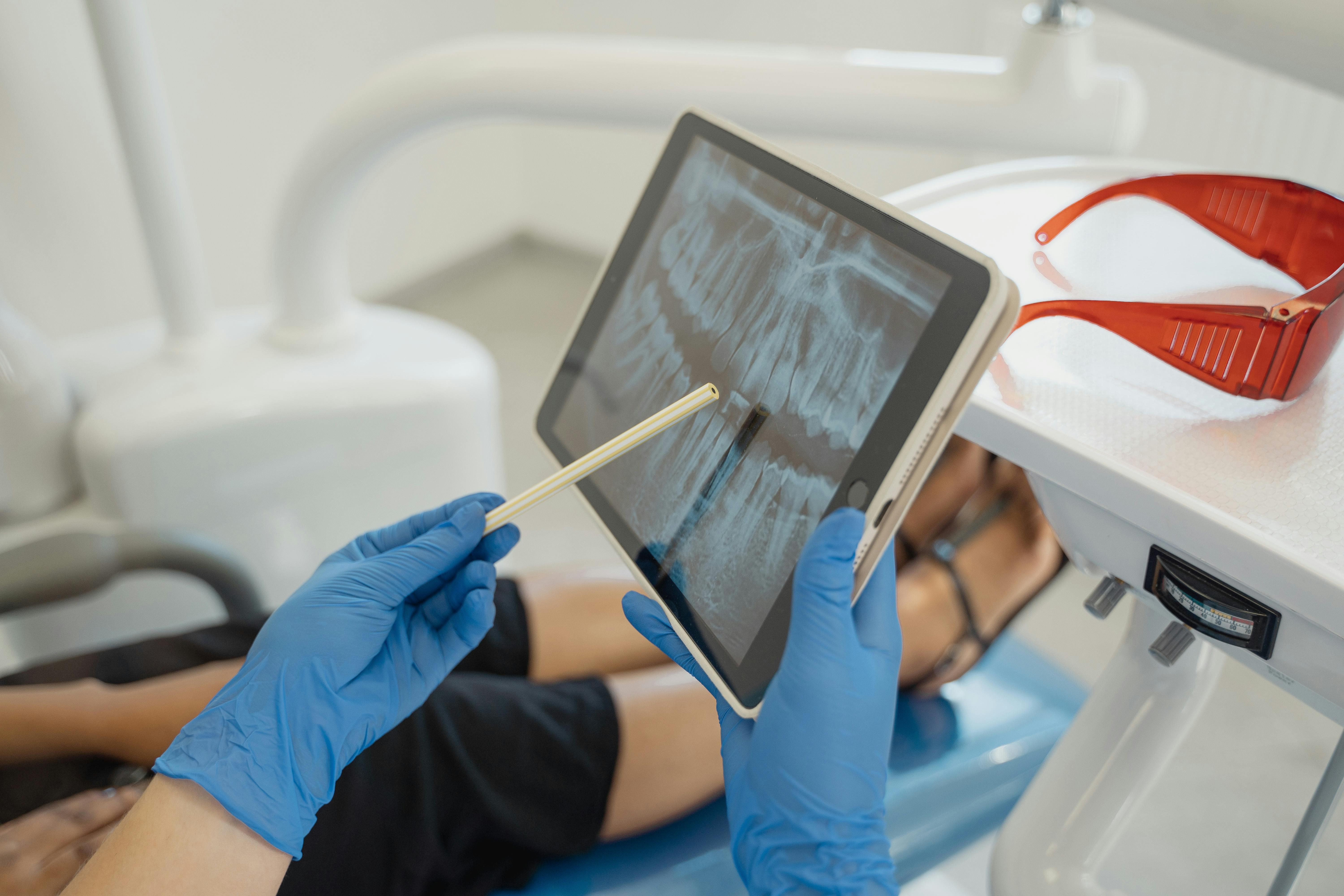 Oral Surgery Consultation